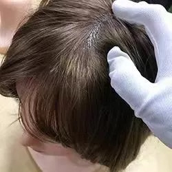 Implanted Synthetic Hair
