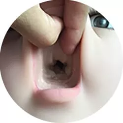 No Teeth – Oral Function